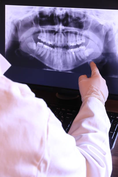 Best Emergency Tooth Extraction in Onsted, MI
